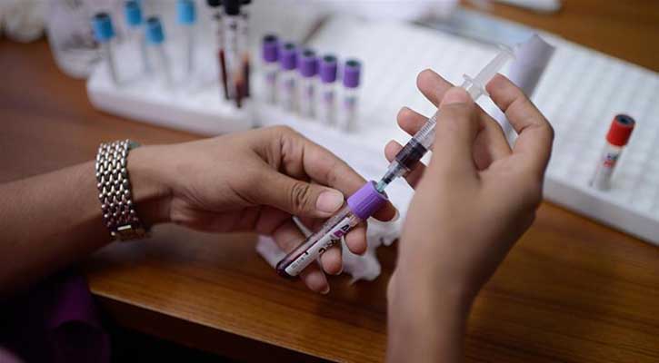 Govt reduces Covid-19 test fees