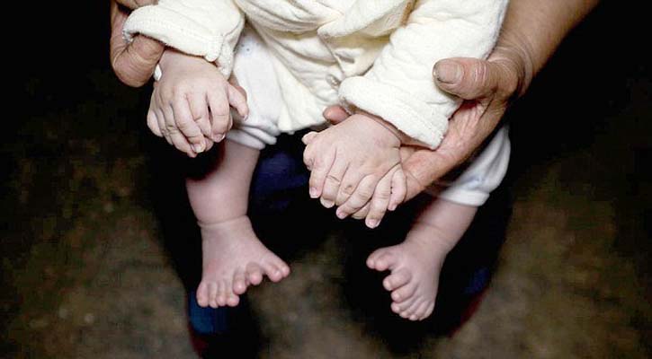 হংহংয়ের হাত ও পায়ে মোট ৩১টি আঙ্গুল