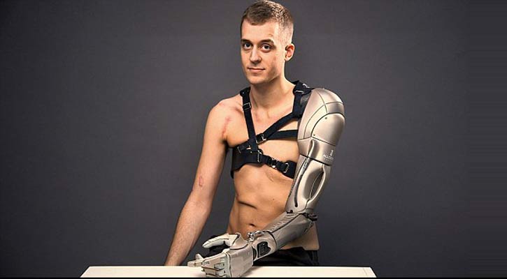 ম্যান উইথ বায়োনিক আর্ম