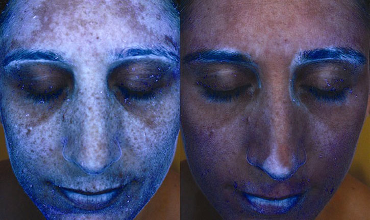 সূর্যরশ্মিতে সান প্রোটেকটিভ মেকআপ কতটুকু সুরক্ষা দেয়?