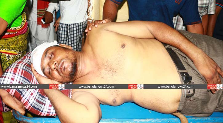 খুলনায় দুর্বৃত্তের হামলায় ইউপি চেয়ারম্যান আহত