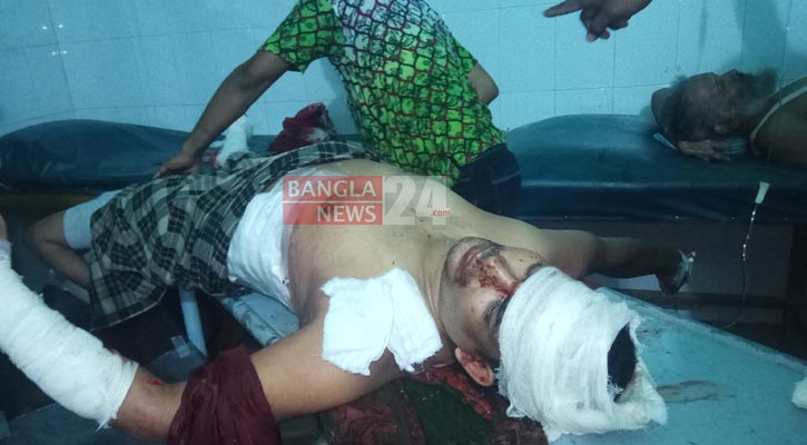 নবাবগঞ্জে জাতীয় পার্টির নেতা ও তার স্ত্রীকে কুপিয়ে জখম