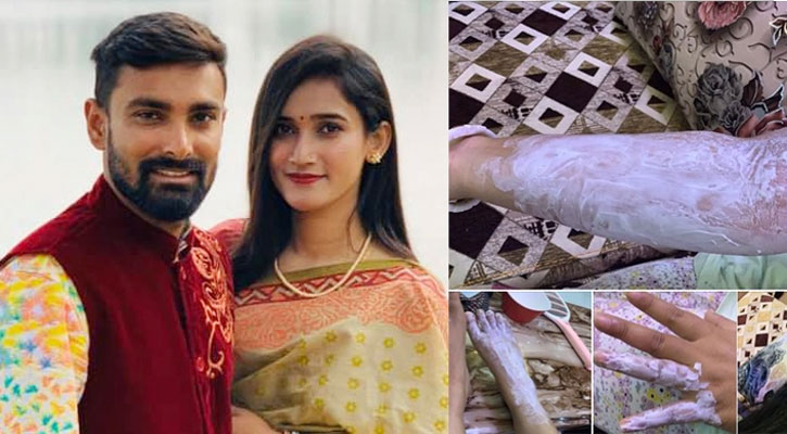 মৃত্যুর খুব কাছ থেকে ফিরে এলেন লিটনপত্নী