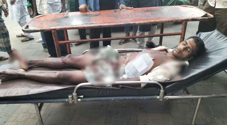 বাঁশখালীতে জমি দখল নিয়ে বন্দুকযুদ্ধ, আহত ২৪