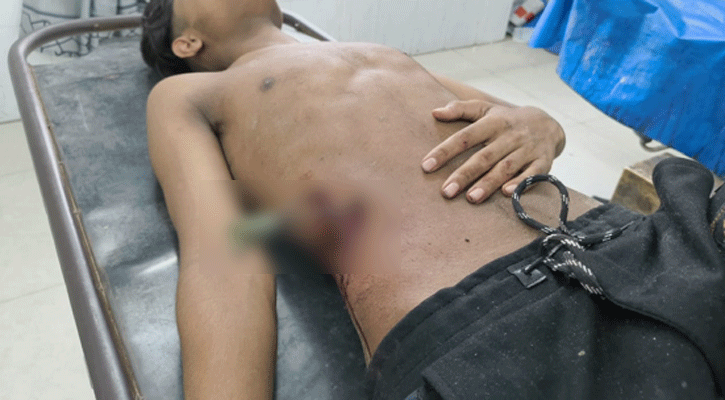 ব্রাহ্মণবাড়িয়ায় আম পাড়াকে কেন্দ্র করে সংঘর্ষ, টেটাঁ বিদ্ধসহ আহত ৮
