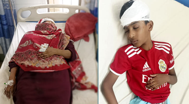 চাঁদপুরে ড্রেনের গ্যাস বিস্ফোরণে মা-ছেলেসহ আহত ৩