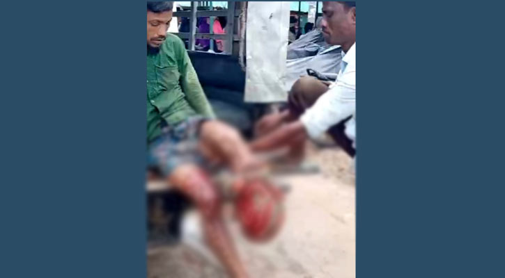 নাইক্ষ্যংছড়িতে মাইন বিস্ফোরণে বাংলাদেশি আহত
