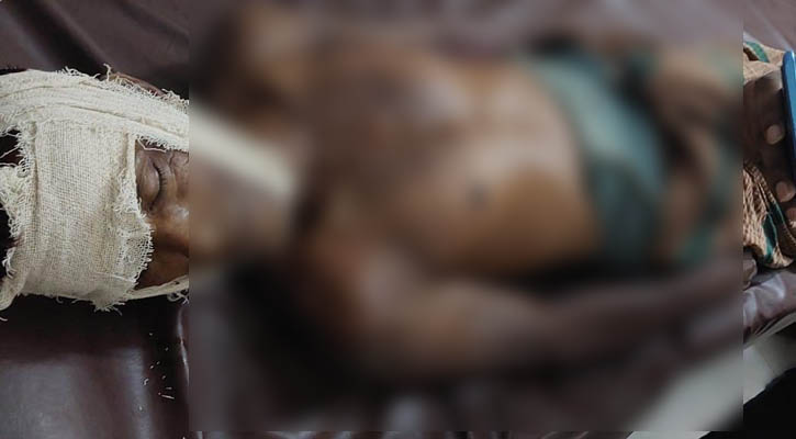 সিলেটে ইউএনওর গাড়িচাপায় প্রাণ গেল রাখালের